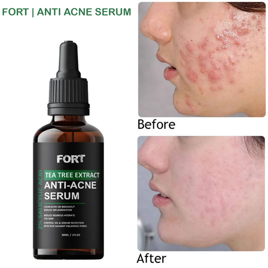 For Anti Ane Serum